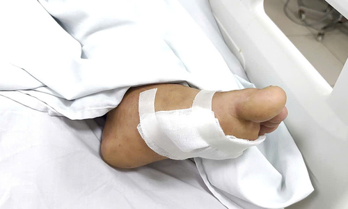 Minor scratch leaves man in critical condition