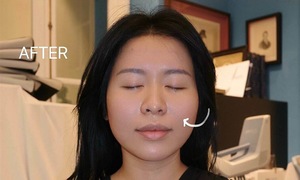 Technologies driving non-invasive aesthetics in Vietnam