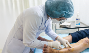 Nodular lesions across limbs due to chronic dermatitis