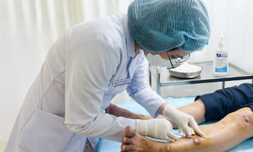 Nodular lesions across limbs due to chronic dermatitis