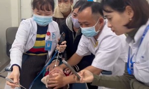 Parasitic leech removed from 2.5-year-old boy's nose after a week