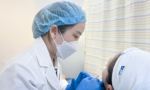 HA injections fill deep sunken eye sockets