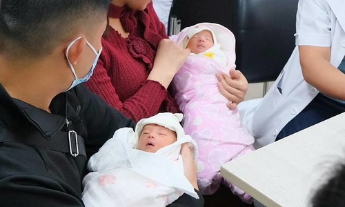 Rare case of monochorionic monoamniotic twin pregnancy