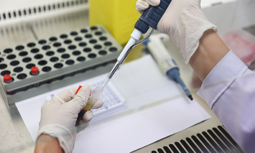 Group aged 15-29 accounts for nearly half of new HIV cases in Ho Chi Minh City