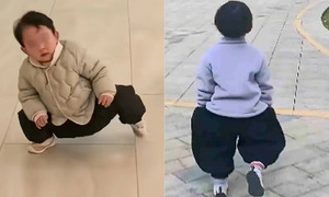 Mother cures daughter's hip dysplasia with 'duck walk' exercises