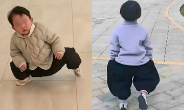 Mother cures daughter's hip dysplasia with 'duck walk' exercises