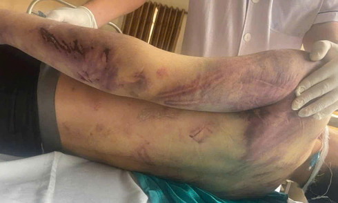 Director of social center where teenager died prosecuted