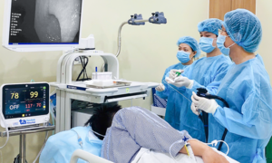 Endoscopy detects early-stage stomach cancer