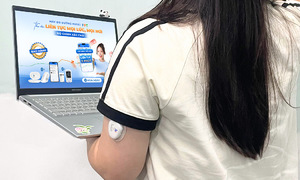 3P monitor keeps pace with CGM technology growth