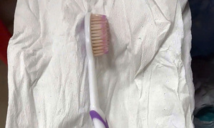 Toothbrush removed from female patient's esophagus
