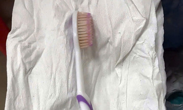 Toothbrush removed from female patient's esophagus