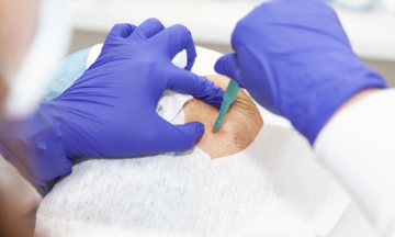 Does biopsy worsen cancer?