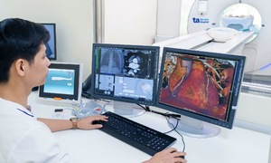 Blocked coronary arteries diagnosed after month-long chest pain