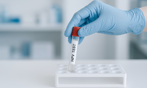 Can you get HPV without sexual intercourse?