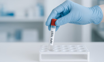 Can you get HPV without sexual intercourse?