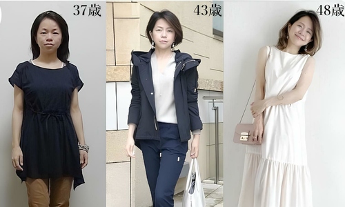 A woman's non-surgical transformation journey