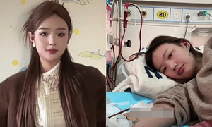 Gained nearly 30 kg, thought it was obesity, turned out to be end-stage kidney failure