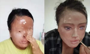Redrawing her face after an acid attack by her ex-husband