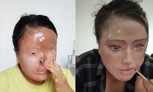 Redrawing her face after an acid attack by her ex-husband