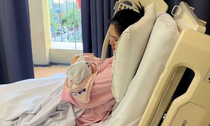 Fetus suffers umbilical cord prolapse