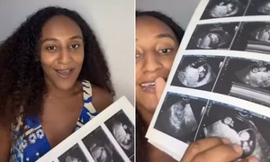 Woman conceives second baby while already pregnant