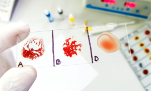 Woman in China found with extremely rare 'dinosaur blood' type