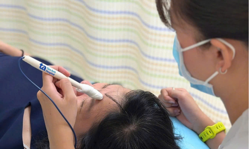 Facial nerve paralysis due to cold exposure