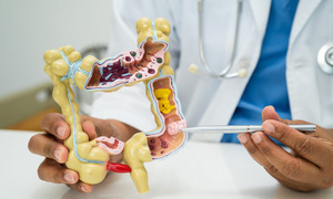 Colorectal cancer becomes the 'number one killer' for young americans