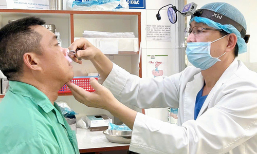 Decades-Old Frontal Sinus Mucocele Causes Eye Protrusion