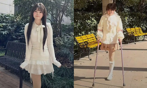 Young woman with bone cancer abandoned by family, signs surgical consent herself