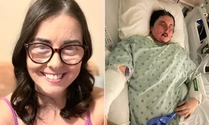Single mother left blind, skin necrotic after drug reaction