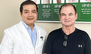 Dr.Vein applies new technology in varicose vein treatment