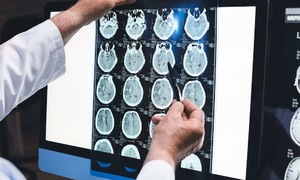 Is sudden headache a sign of stroke?