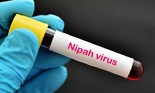 Signs of Nipah virus infection easily mistaken for the flu