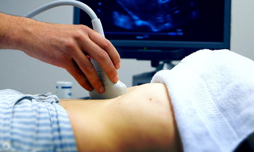 73-year-old man receives 'early intrauterine pregnancy' ultrasound result