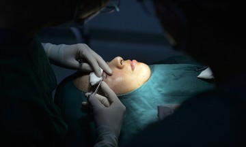 The dark side of China's cosmetic surgery craze