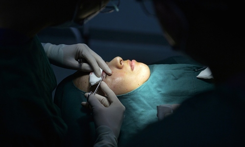 The dark side of China's cosmetic surgery craze