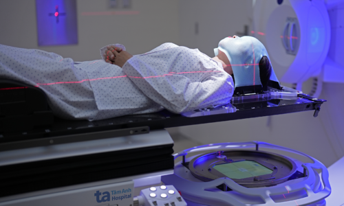 How is radiotherapy performed after brain tumor surgery?