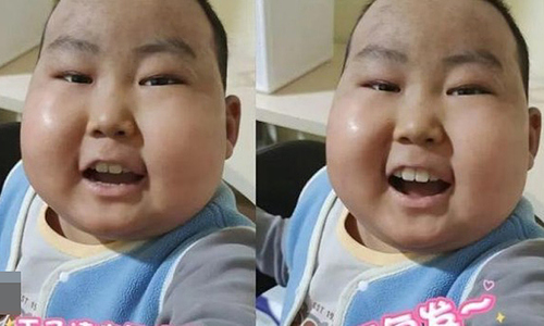 Young cancer patient viewed bitter medicine as 'dessert'