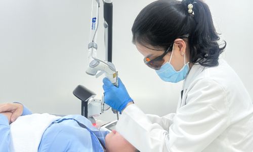 treating mixed melasma with laser