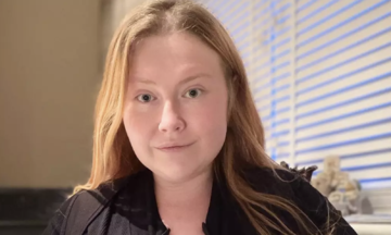 Woman's breasts continue to grow despite 32 kg weight loss due to rare condition