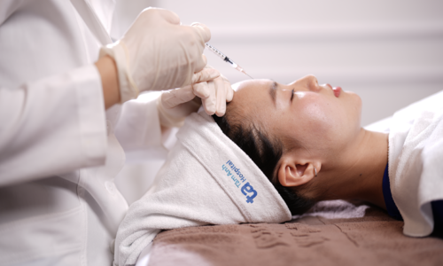 After filler injections, should sticky rice and chicken be avoided?