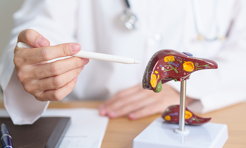 Harvard doctor reveals how to reverse fatty liver without medication