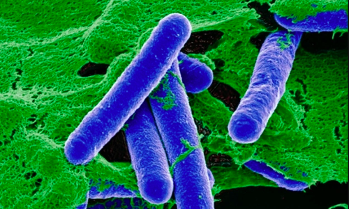 Ministry of health warns of 'nerve-damaging' toxin in fermented, canned foods