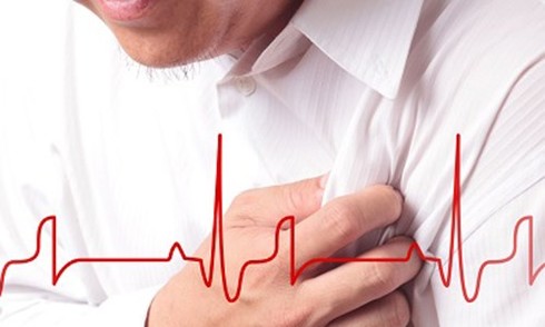 The 'Tet holiday effect' on individuals with stents and cardiovascular interventions