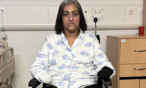 Dog lick leads to sepsis, woman loses all four limbs