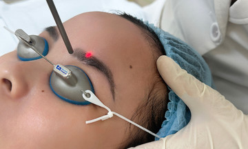 Does eyebrow tattoo removal cause hair loss?