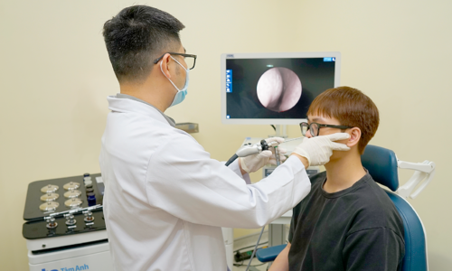 How to reduce allergic rhinitis without medication