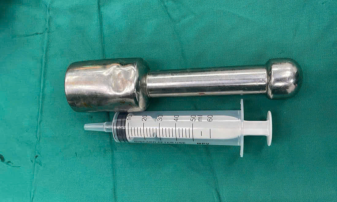 Teenager inserts 18 cm pestle into rectum