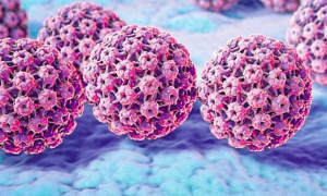 20-year-old pregnant woman contracts genital warts